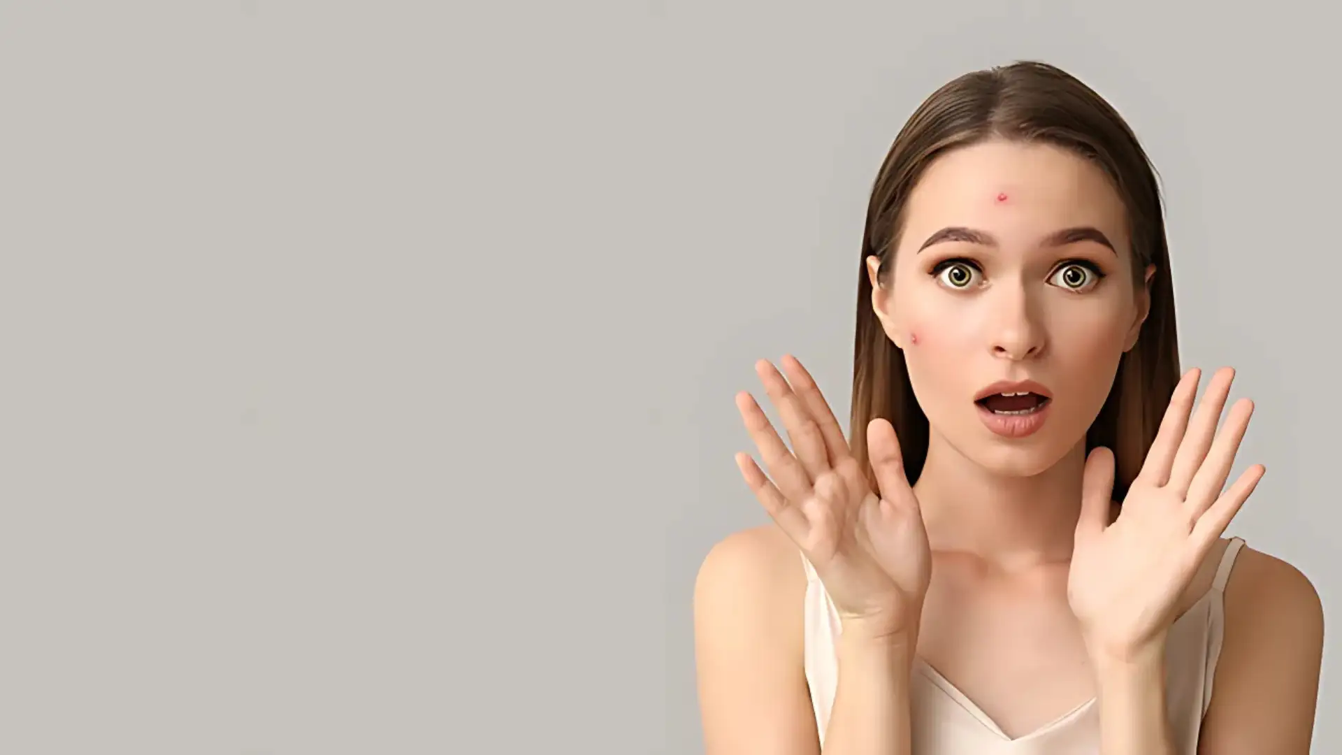 Acne Treatment in Dubai Causes, Treatment Options, and How to Achieve Clearer Skin
